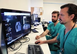 La Fe de Valencia realiza una terapia pionera en España para tratar la compresión medular metastásica