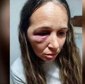 A prisión cuatro okupas por propinar una brutal paliza a una pareja en Bujalance: «Me dejaron inconsciente»