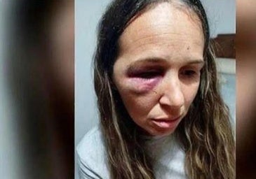 A prisión cuatro okupas por propinar una brutal paliza a una embarazada y a su pareja en Bujalance: «Me dejaron inconsciente»