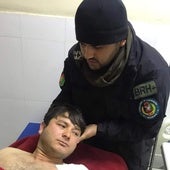 El militar Mukhtar Hazrat Oghli fue herido en combate
