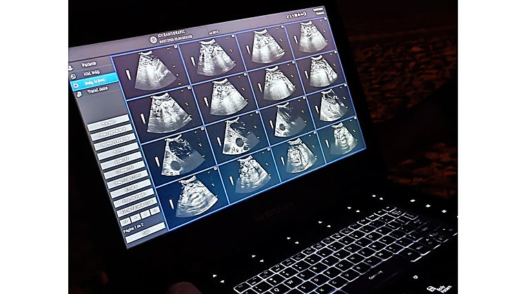 Ecografía realizada al animal para comprobar si tenía más huevos dentro