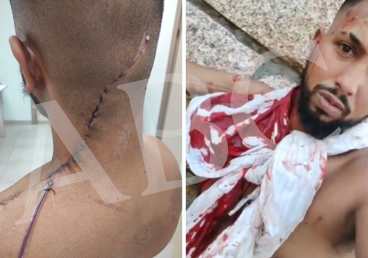 David, de la familia Bentos, enseña las heridas consecuencia de la reyerta