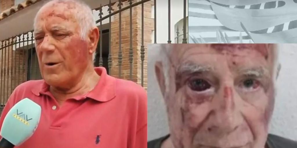 La Guardia Civil investiga una brutal paliza de un grupo de jóvenes a un vecino de Torre Pachecho (Murcia)