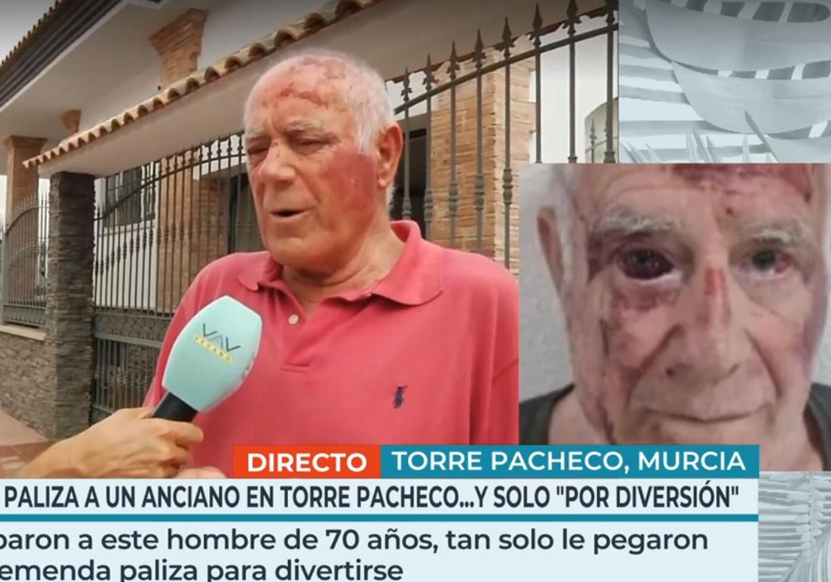 Domingo, la víctima agredida este miércoles en Torre Pachecho (Murcia) por un grupo de jóvenes
