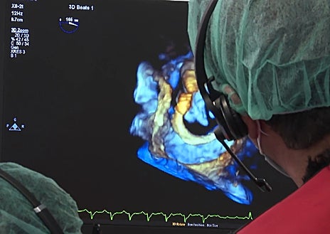 Imagen secundaria 1 - La operación pionera en España 