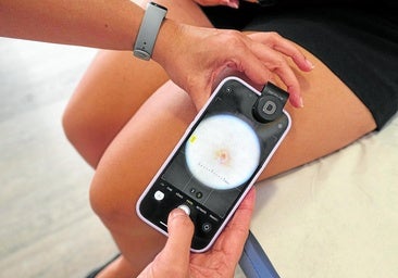 Las 'fotoconsultas' para agilizar la lista de espera en Dermatología