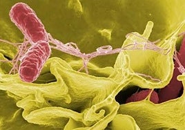 Más de 100 personas afectadas por un brote de salmonelosis en un hotel de La Manga (Murcia)