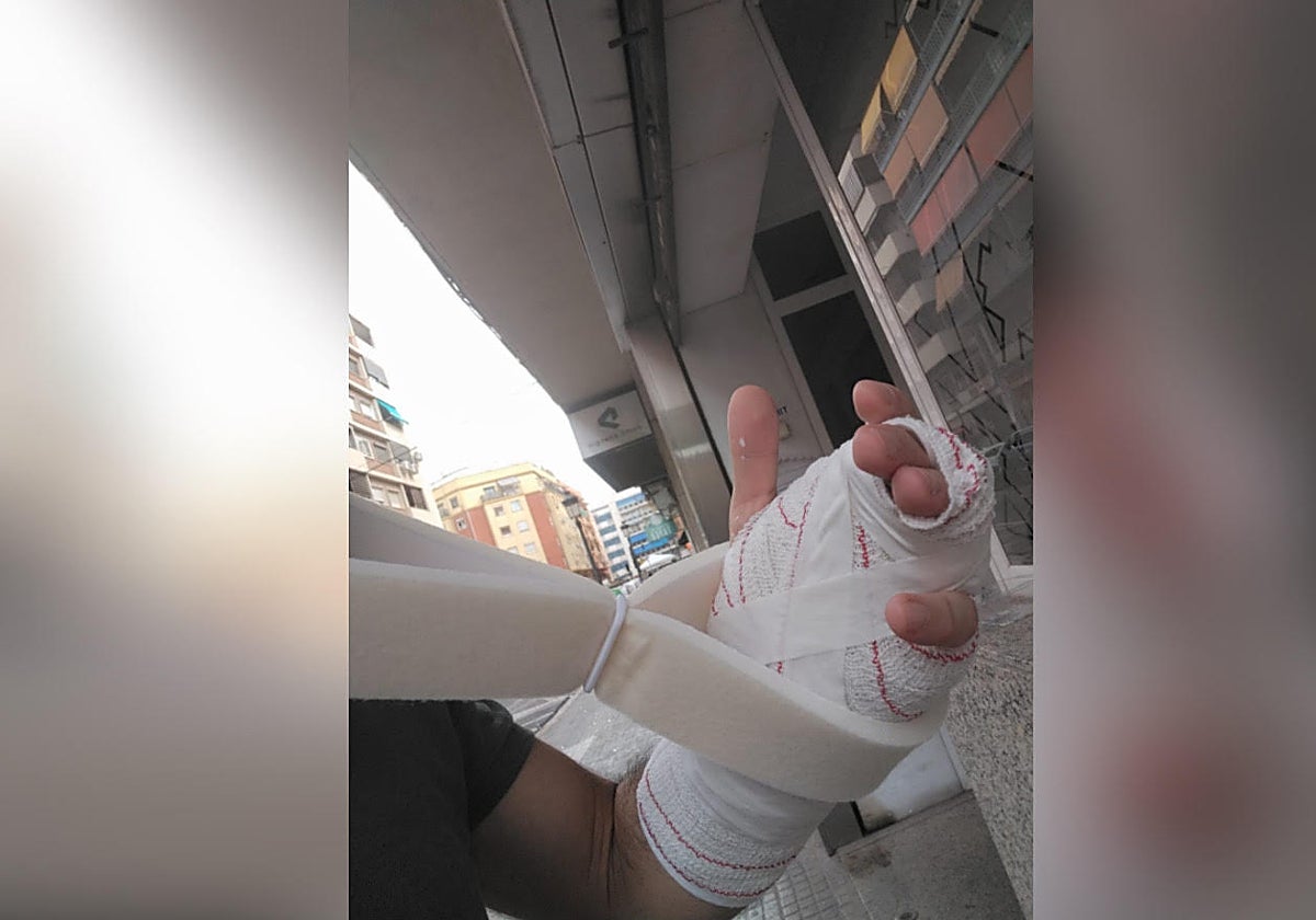 Imagen del brazo facturado de un funcionario de la prisión de Picassent, en Valencia