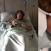 Le rompen cuatro costillas y la cara a una mujer de 63 años para robarle el patinete