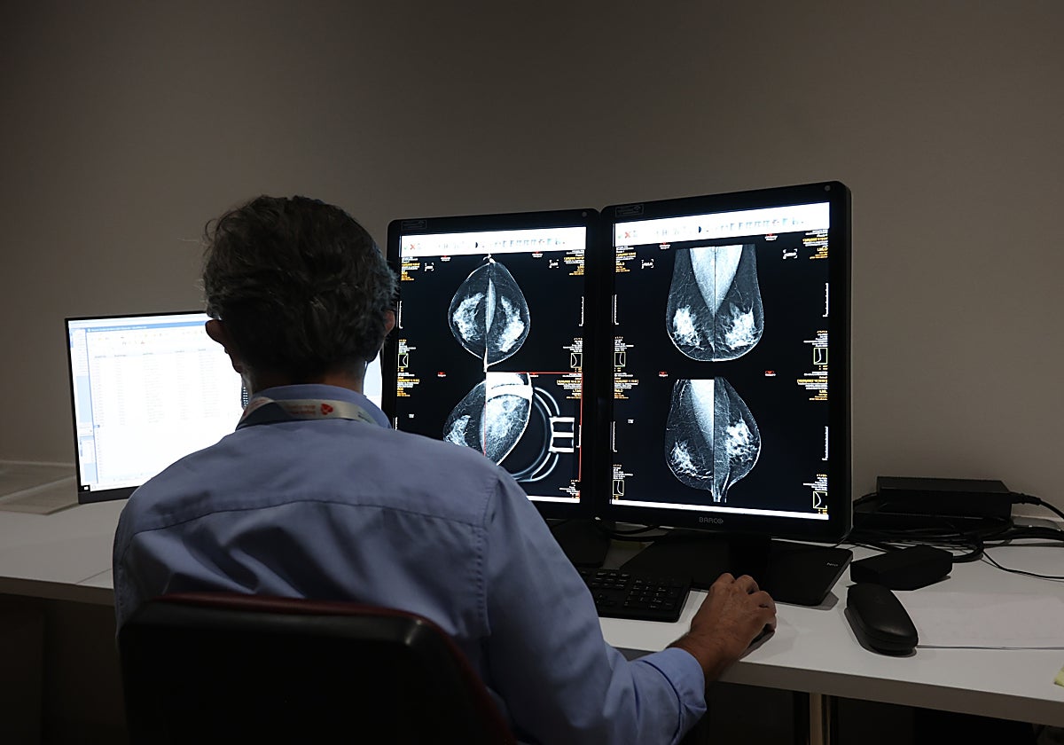 Un sanitario consulta los resultados de una mamografía en el Centro de Especialidades Carlos Castilla del Pino de Córdoba