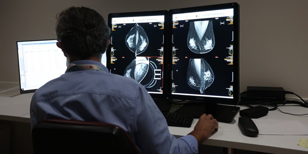 Los fallos en el cribado de cáncer de mama se deben a la autonomía de los hospitales de Andalucía al dar los resultados