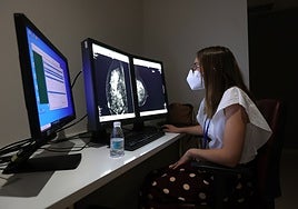 Los fallos de coordinación en el cribado de cáncer de mama en Andalucía se remontan a 2012, con el PSOE en la Junta