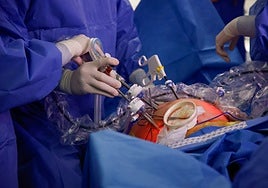 La lista de espera quirúrgica sigue en descenso en Aragón y alcanza una reducción del 27% interanual