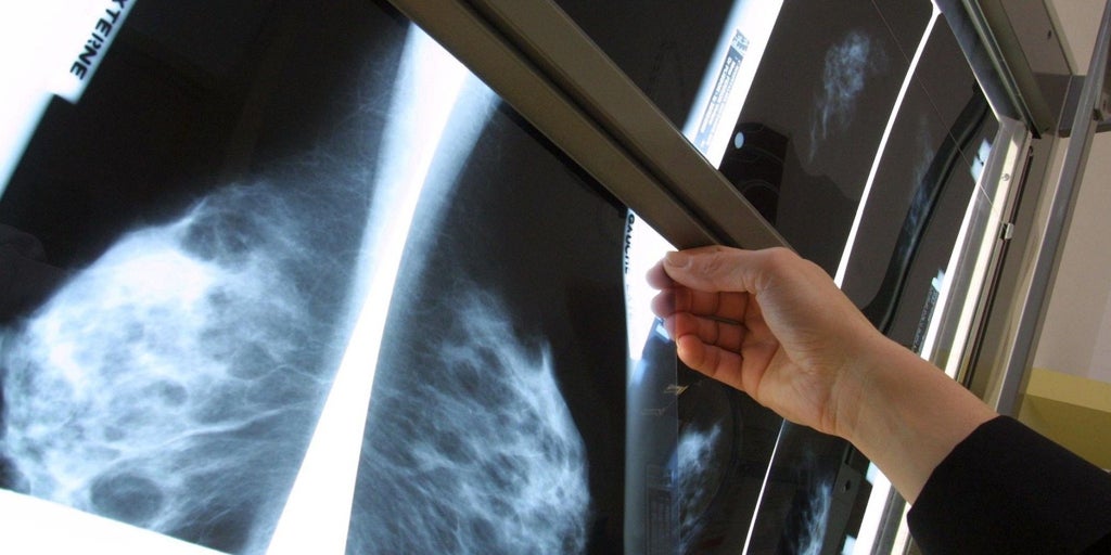 «Es difícil vivir con preocupación a la espera de una mamografía», comparte una paciente del área sanitaria de Talavera