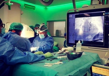 El Hospital Quirónsalud implanta con éxito el primer desfibrilador extravascular en la medicina privada en España