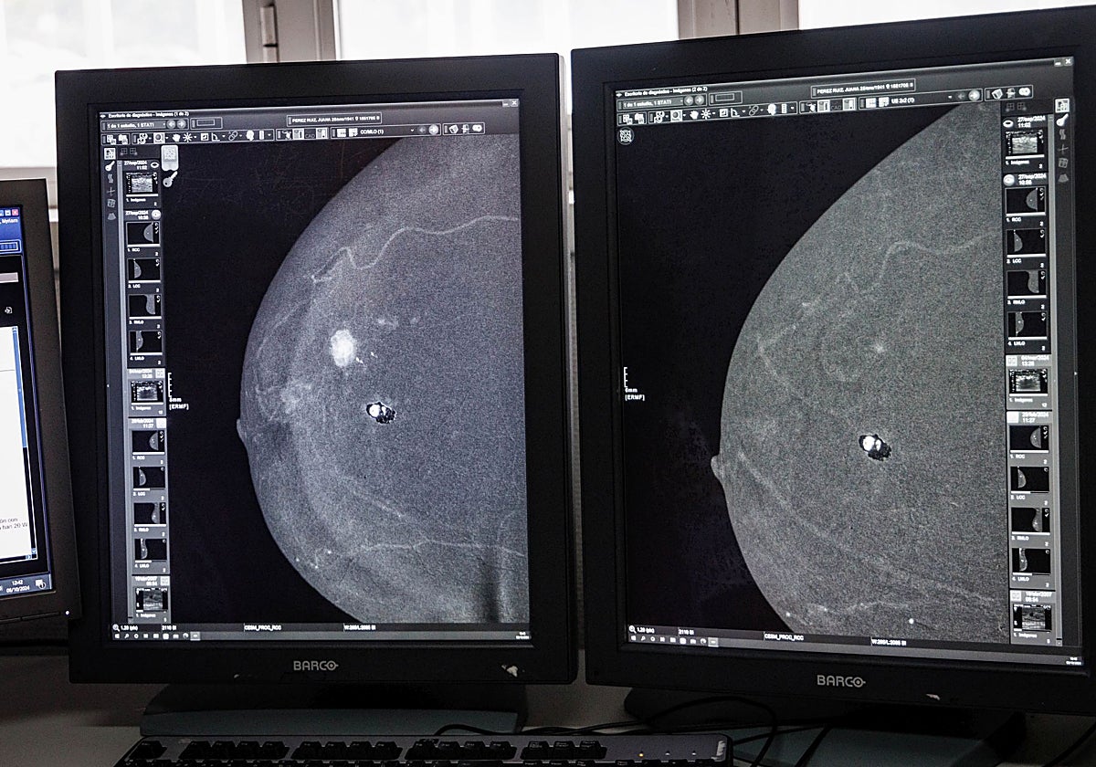 A la huelga están llamados los técnicos de laboratorio, radiología, anatomía patológica o medicina nuclear