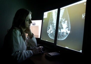 Andalucía es la comunidad que más mujeres incluye en el cribado del cáncer de mama junto a Galicia, Murcia y Valencia