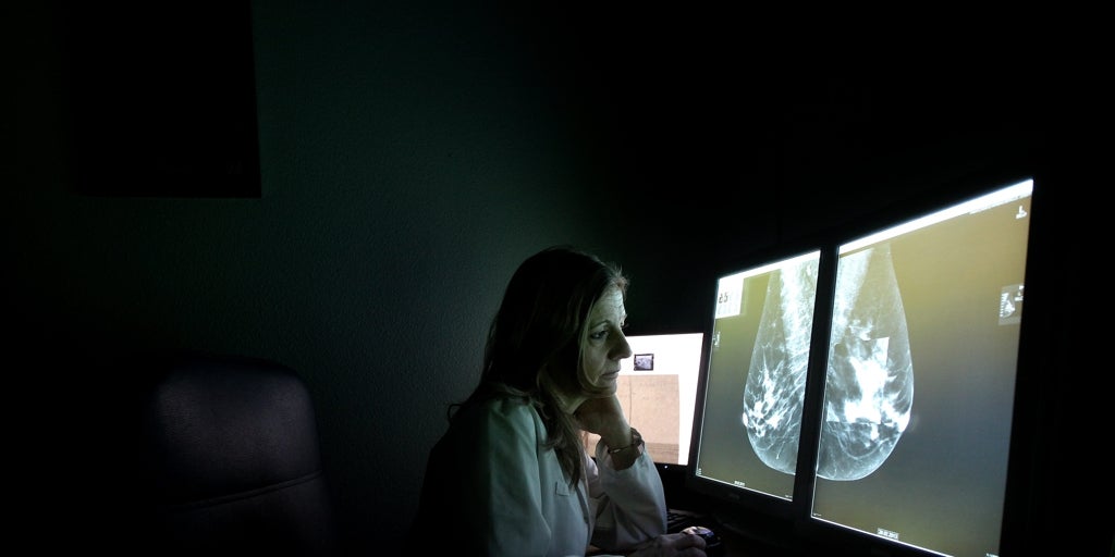 Andalucía es la comunidad que más mujeres incluye en el cribado del cáncer de mama junto a Galicia, Murcia y Valencia