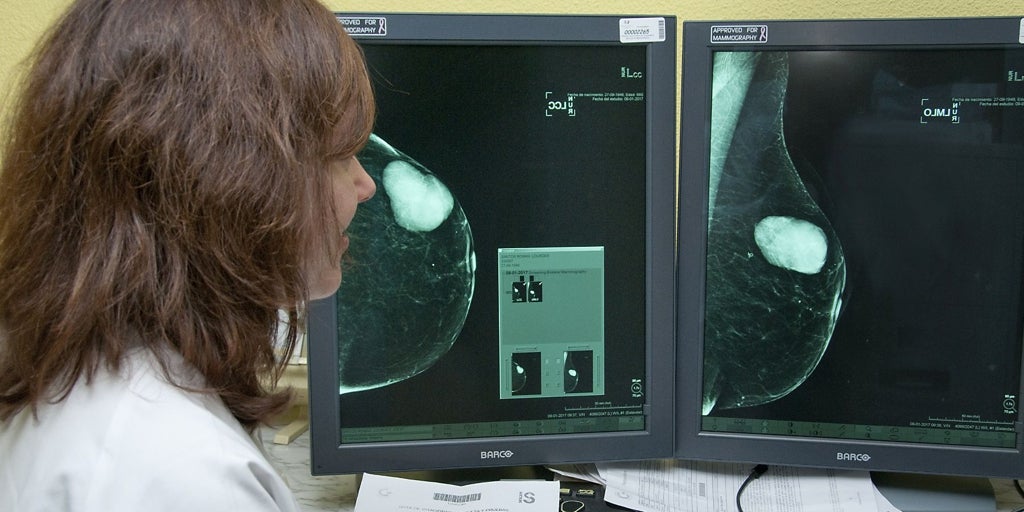 La lista de espera del cribado de cáncer de mama se extiende a Toledo y afecta al menos a otro millar de mujeres