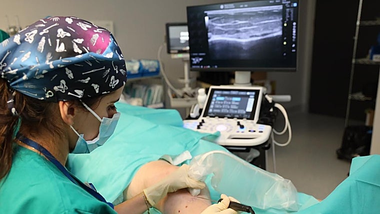 La nueva técnica es mínimamente invasiva y tiene como ventajas la inmediatez de la consecución del resultado, la obtención de un efecto duradero y la posibilidad de tratar a pacientes con marcapasos sin interferir en el funcionamiento del mismo