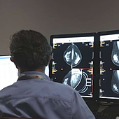 La IA para los nuevos cribados en Andalucía detecta un 54% más de cánceres de mama