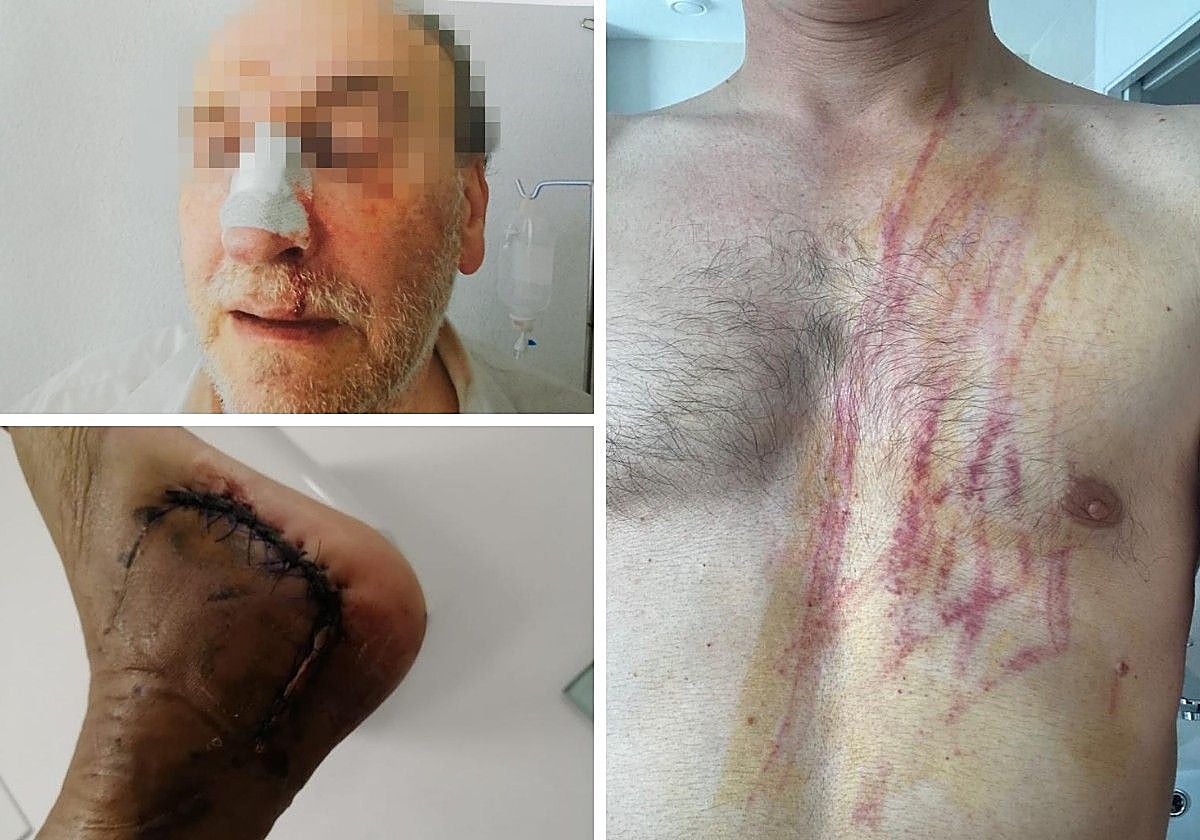 Lesiones que han sufrido funcionarios de prisiones en actos de servicio