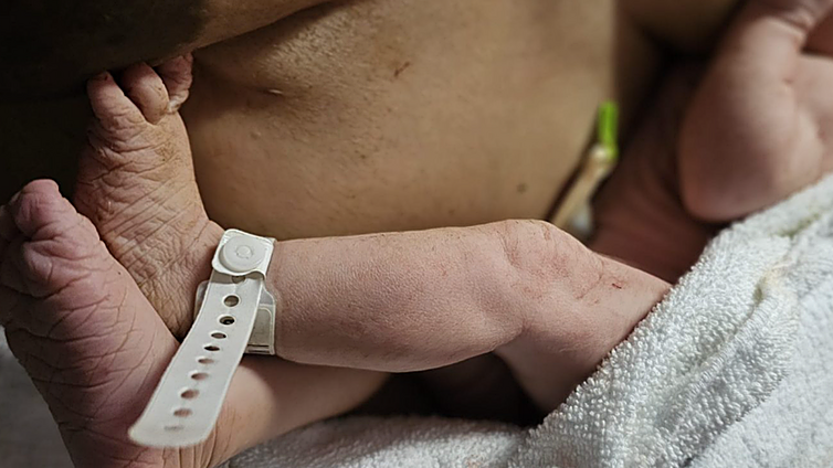 Un 7% de la población canaria conviviría con una enfermedad rara: 140.000 personas