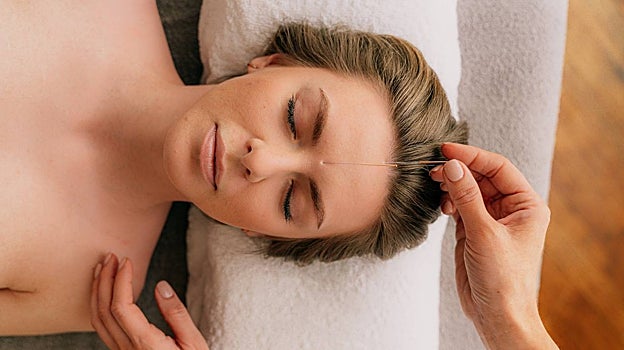 La acupuntura estética es una técnica milenaria china que ayuda a relajar las arrugas, combatir la flacidez y favorecer la producción de colágeno, elastina y ácido hialurónico, esenciales para retrasar el envejecimiento de la piel del rostro.