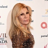 El cambio físico de Donatella Versace analizado por doctores expertos en estética