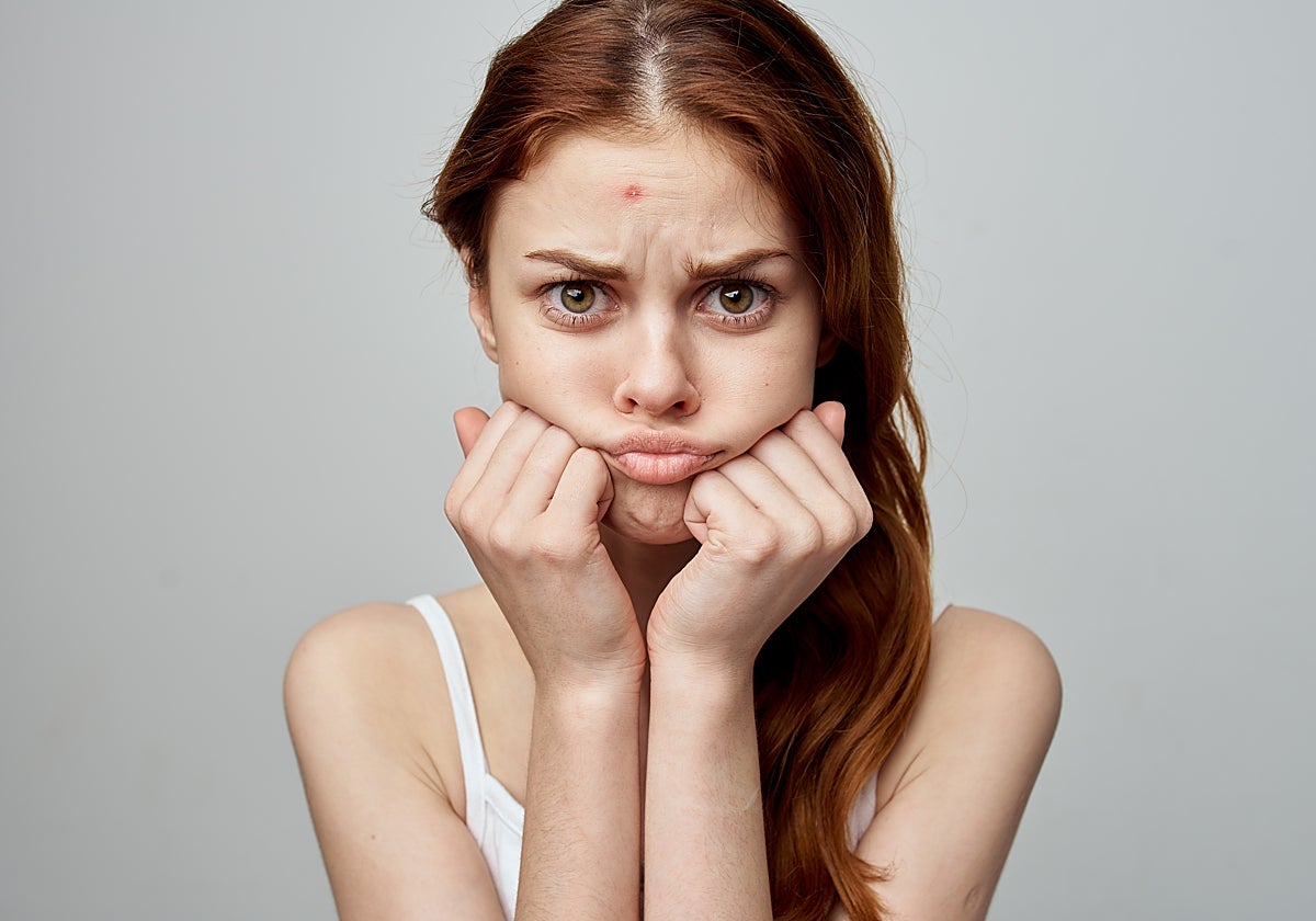 Adolescentes: ¿Me puedo poner crema solar si tengo acné?