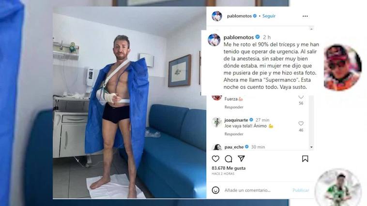 Pablo Motos, operado de urgencia tras romperse el 90% del tríceps