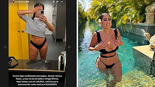 'Stories' de Anabel Pantoja y una de las imágenes en las que la acusan de retocar su imagen