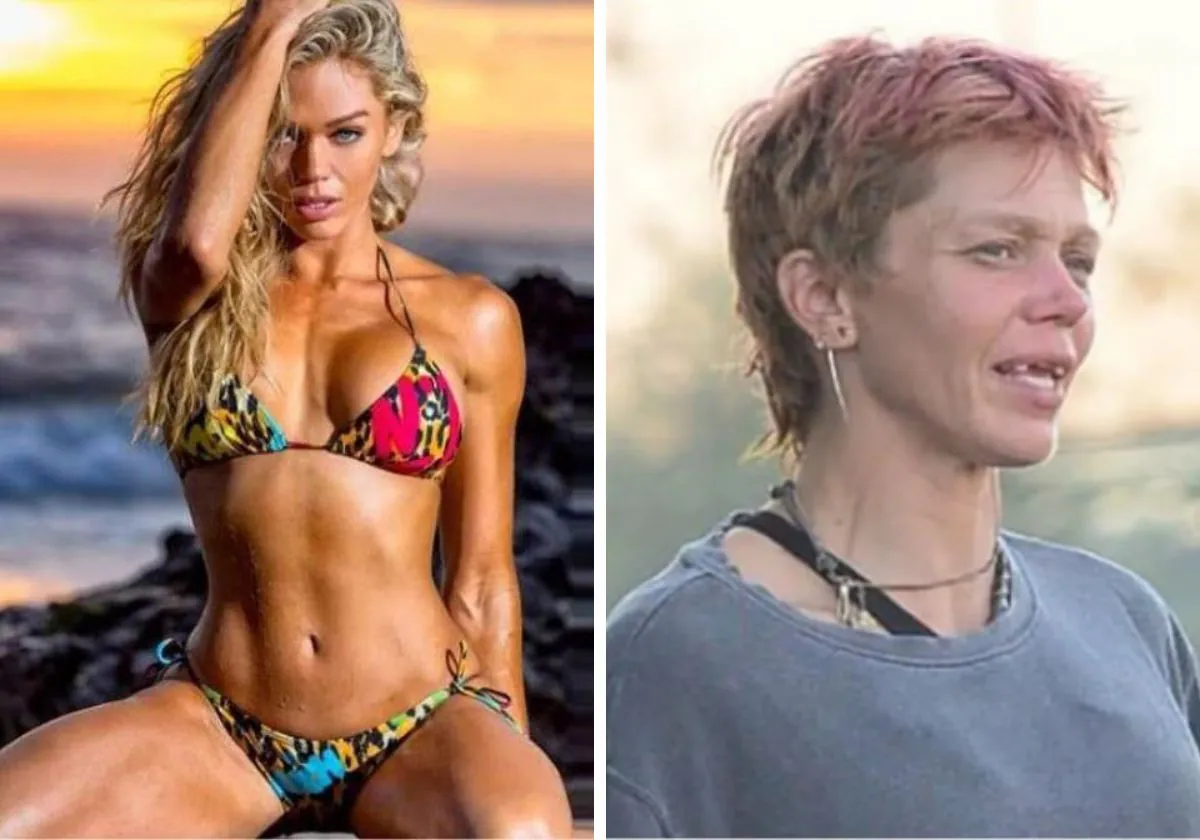 De supermodelo y expareja de una de las estrellas de 'Los vigilantes de la  playa' a sin dientes y en la indigencia