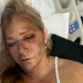 Virginia Giuffre abandona el hospital una semana después de estar «cerca de morir»
