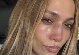 El accidente de Jennifer Lopez durante los ensayos de los Premios AMA: «Esto es lo que pasó»