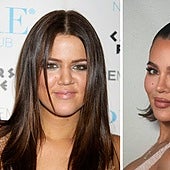 Khloé Kardashian desvela el sinfín de retoques que se ha hecho