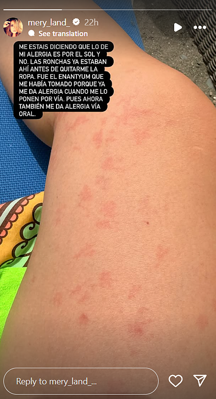 El inesperado revés de salud de María José Campanario en plena escapada familiar