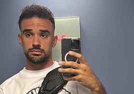 IlloJuan revela su injerto capilar en directo y enseña los resultados: «Me daba muchísima vergüenza hablar del tema»