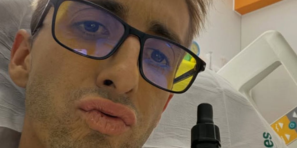 Muere a los 28 años el influencer Xisco Quesada tras una dura batalla con un agresivo cáncer de páncreas