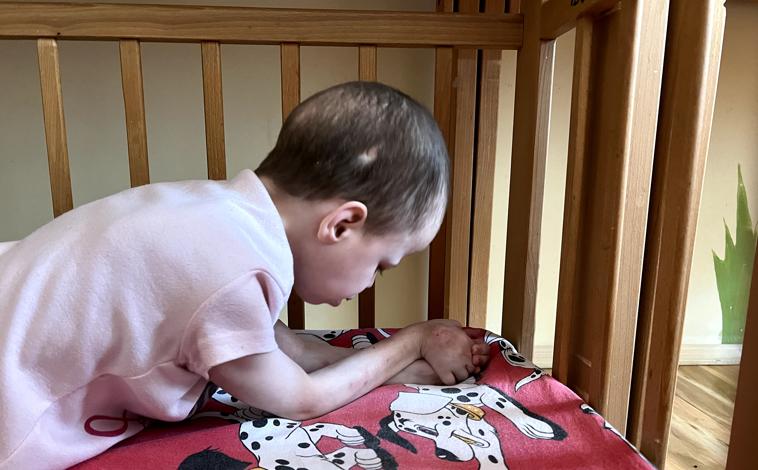 Imagen principal - IIIIIimagen superior, un residente de un orfanato de treinta años que parece un niño; la foto de la izquierda es de un joven de unos 20 años en silla de ruedas con comportamiento autoabusivo en la Institución Ladyzhyn; foto de la derecha de la Institución Ladyzhyn, donde gran parte de los mayores de 18 años pasan toda su vida en estas cunas