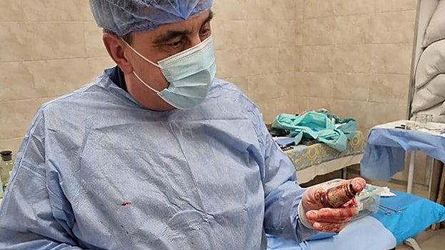 El cirujano muestra la granada extraída del soldado ucraniano.