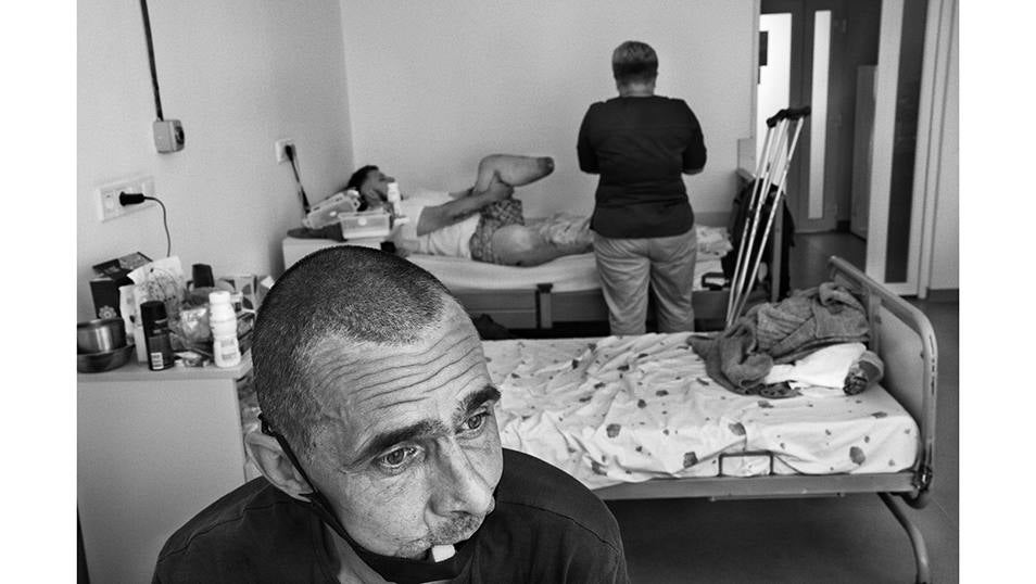 Leópolis, Ucrania - Junio 28, 2023: Hor (apodo Zahar) es parte de la Brigada 28 que combate en Bajmut. En un combate cuerpo a cuerpo contra tropas Wagner fue herido varias veces en los brazos y en la cara. Ahora se recupera en San Panteleimon en Leópolis y espera a una cirugía plástica para intentar reconstruir su rostro