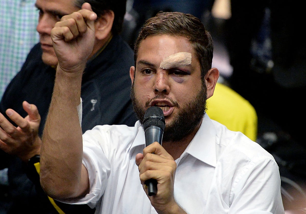 Imagen de archivo de Juan Rrequesens, exdiputado venezolano