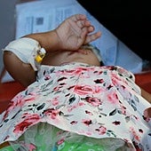 Hamás apoya la petición de Guterres de pausas humanitarias en Gaza para una campaña de vacunación contra la polio