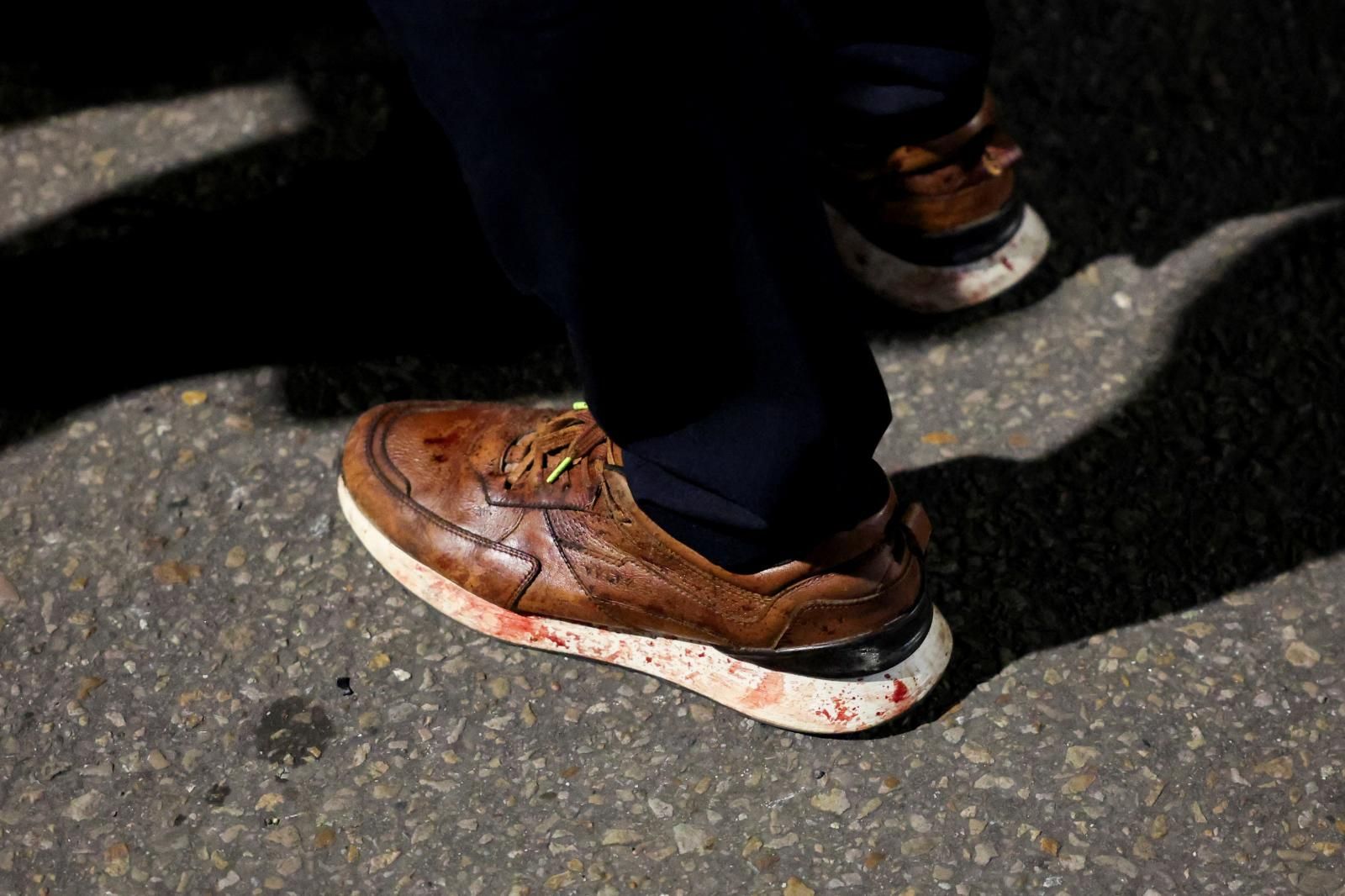 Manchas de sangre en los zapatos de Víctor Mosquera, concejal del partido Centro Democrático, que colaboró en el rescate del senador colombiano Miguel Uribe.