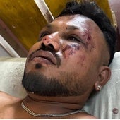 El único superviviente del accidente de la India: «Después del despegue, hubo un ruido y el avión se estrelló»