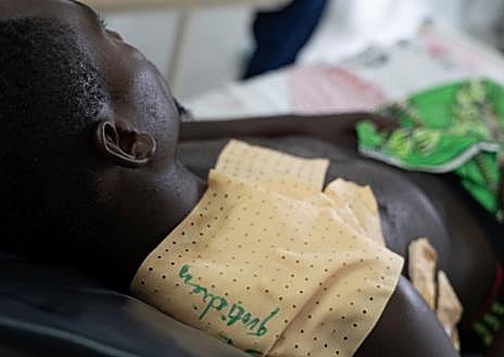 Imagen secundaria 1 - MSF atienden en quirófano a un herido en el Hospital de Rutshuru, en la primera foto. En la segunda imagen, un joven herido, por un disparo de hombres armados mientras trabajaba en los campos de Kibirizi en agosto, se recupera en el hospital. En la tercera foto, el Dr. Karry Felix (MSF) repasa la lista de operaciones del día