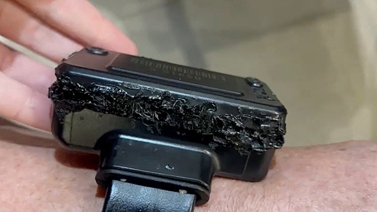 Resultado del sabotaje de la tobillera electrónica del expresidente Bolsonaro