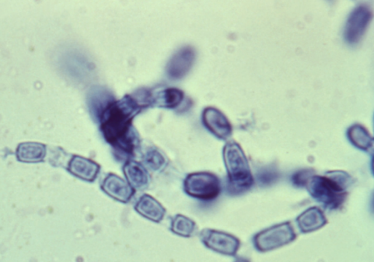 Coccidioides