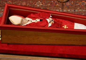El hematoma de Francisco